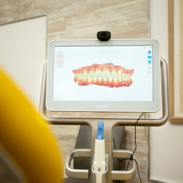3D image of teeth on the device ITero